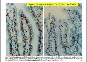 Gut Inflammation