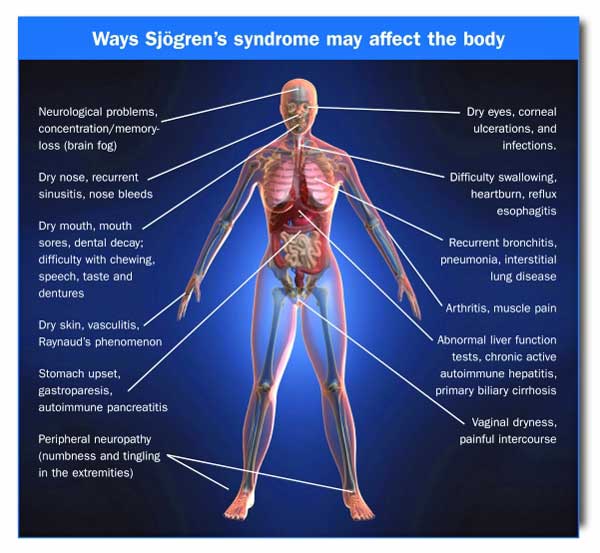 Symptoms chart