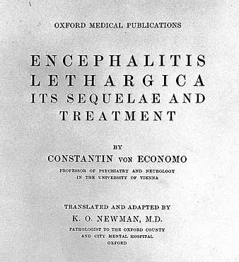 Encephalitis lethargica 