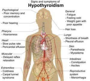 The Atypical Thyroid Issues in Chronic Fatigue Syndrome (ME/CFS), Plus ...