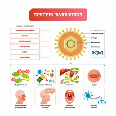 Epstein-Barr virus