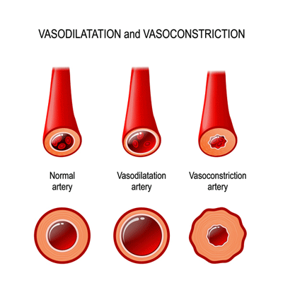 Vasoconstricted blood vessels