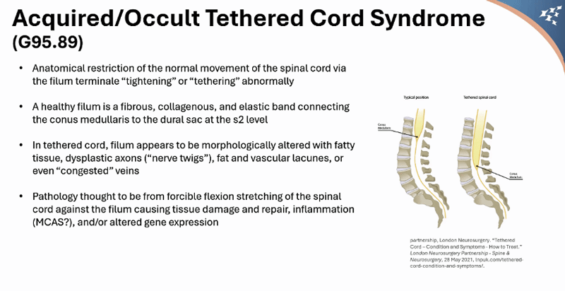 Tethered Cord