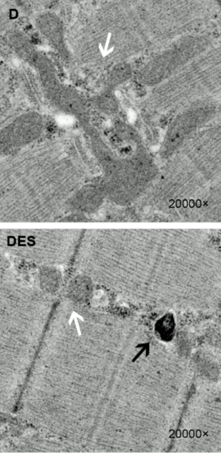 Swollen mitochondria