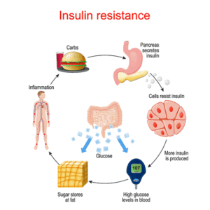 Insulin resistance