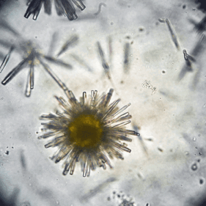 Uric acid crystals